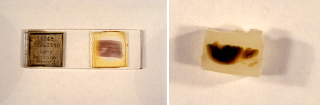 Micro slide and sample of lung tissue 
