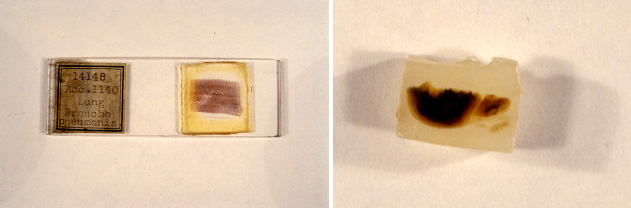 Micro slide and sample of lung tissue